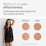 Épilateur électrique IPL pour femmes – Épilation permanente